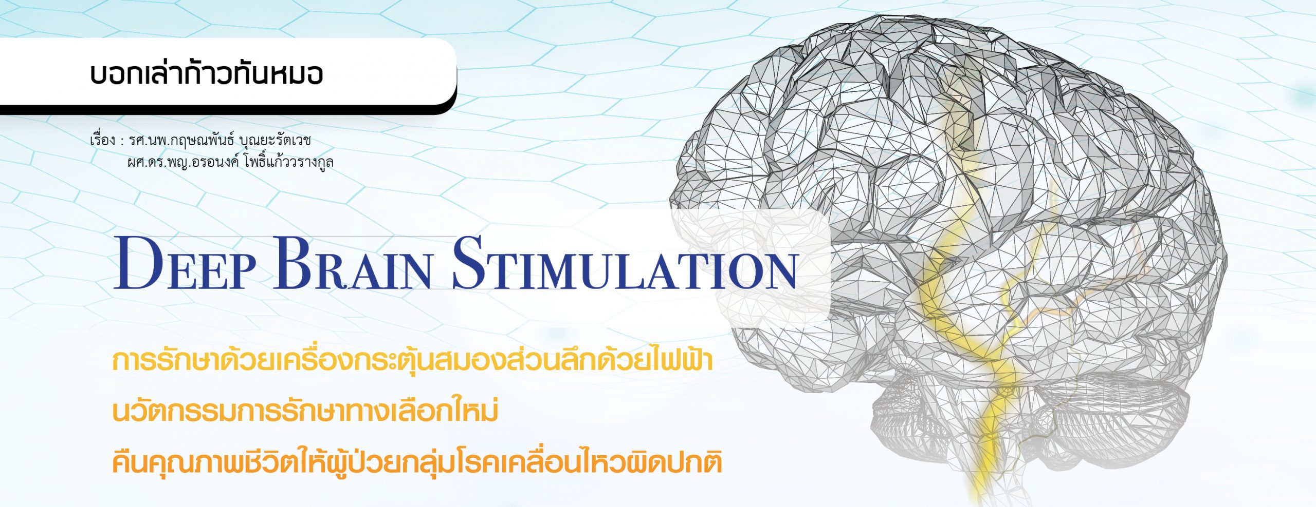 การรักษาด้วยเครื่องกระตุ้นสมองส่วนลึกด้วยไฟฟ้า